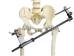 Kit de instrumentos ortopédicos para la reducción de fracturas óseas de extremidades inferiores, suministro médico para el cuidado de la salud, separador femoral, retractor tibial - Product Image 6