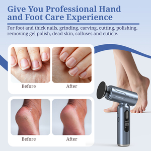 <span class=keywords><strong>Lime</strong></span> Électrique Pieds Anti-Callosités 2 en 1, Râpe à Pieds Électrique et <span class=keywords><strong>Ponceuse</strong></span> à <span class=keywords><strong>Ongles</strong></span> Rechargeable, Outils de Pédicure pour Peaux Mortes - Product Image 3