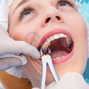 Pinzas de Extracción Dental de Alta Calidad, Pinzas de Extracción Dental al Mejor Precio para Venta en Línea - Product Image 3