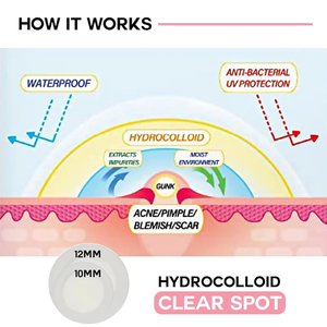 แผ่นแปะดูดซับสิวไฮโดรคอลลอยด์ ผลิตในเกาหลี ขนาด 10 มม. และ 12 มม. ผสมกรดซาลิไซลิกออร์แกนิก สำหรับรักษาสิวบนใบหน้า ขายส่ง - Product Image 4