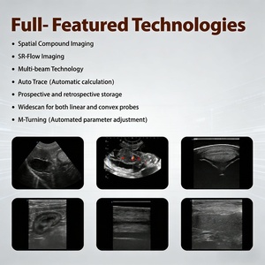Ecógrafo Veterinario Portátil E1ExpV SonoScape con Doppler Color para Diagnóstico Reproductivo y de Gestación <span class=keywords><strong>Abdominal</strong></span> - Product Image 5