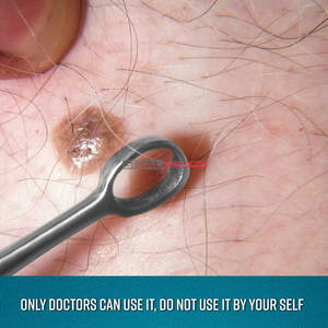 Curetas de oído de piel de zorro de calidad premium, bucles quirúrgicos de acero inoxidable, instrumento manual de ORL, certificado CE, para eliminación segura de cera de oído - Product Image 6