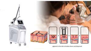 Macchina di rimozione del tatuaggio del Laser di ADSS, inchiostro, pigmenziona e macchina di rimozione del segno di nascita, macchina ND-YAG del Laser di PICO - Product Image 6