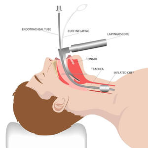 Ensemble de laryngoscopes à 4 lames incurvées en acier inoxydable LED électriques certifiés CE ISO, instruments chirurgicaux réutilisables OEM ODM - Product Image 6