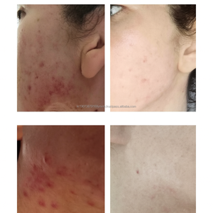 Crema occhi illuminante di bellezza K con burro di karité acido ialuronico al collagene per una pelle luminosa elastica radiante - Product Image 3