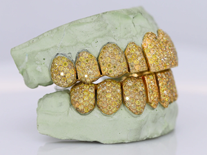 Rappeur Hip Hop glacé Grillz avec personnalisation bijoux dentaires de qualité supérieure décoration de dents personnaliser couleur jaune Grillz - Product Image 3
