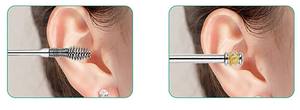 Ensemble de nettoyage d'oreilles de qualité supérieure, outils de suppression de cérumen en acier inoxydable - Product Image 4