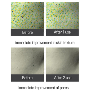 Damaged Skin Barrier Repair Redness Relief cica serum DRDRAWING Sensitive Calm Red Skin Reddit 30ml - Product Image 3