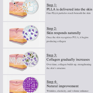 Estimulador de Colágeno PLLA Aribell Orano para Mujeres, Reafirmante de la Elasticidad de la Piel Coreana, Antienvejecimiento, Antiarrugas, Revitalizante, Voluminizador - Product Image 2