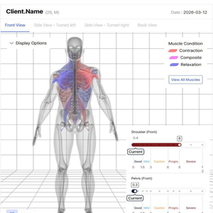 Bodydot BDF1000 เครื่องวิเคราะห์ร่างกายอัจฉริยะด้วย AI ดีไซน์ยืดหยุ่น โครงอะลูมิเนียมอัลลอยด์ ไม่สามารถพับได้ ติดตามท่าทางร่างกายแบบเต็มตัว - Product Image 2
