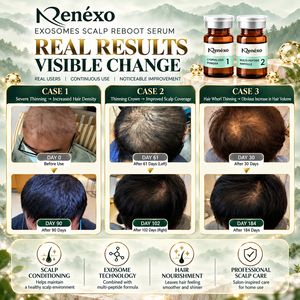 2026 Renxo Exosomes <b>Scalp</b> Reboot Professional Antler Serum Hair-Loss Prevention Normal Hair Repair Kit 8ml - Product Image 5