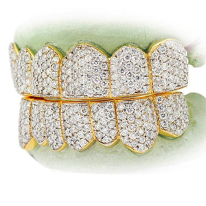 Grillz dentaire Hip Hop personnalisé en argent sterling 925 avec moissanite taille brillant certifiée IGI, 14 dents serties en canal, unisexe, 7 supérieures 7 inférieures - Product Image 2