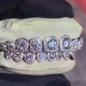 Grillz dentaire Hip Hop personnalisé en argent 925 plaqué or, serti de moissanite, bijoux de corps de luxe pour mariage, fiançailles, cadeau - Product Image 1