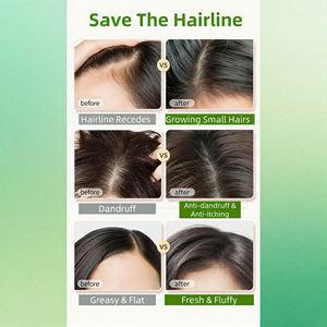 Shampooing antipelliculaire biologique végétalien naturel sans sulfate OEM avec huile d'arbre à thé, traitement du <span class=keywords><strong>psoriasis</strong></span> du cuir chevelu, équilibre de l'huile et rafraîchissement - Product Image 3