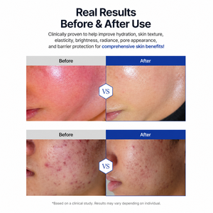 AESTHEIN premium Medi Formula 119 Ampoule 50ml K-Beauty PN PDRN Sérum de soin de la peau multifonctionnel breveté pour minimiser les pores - Product Image 3