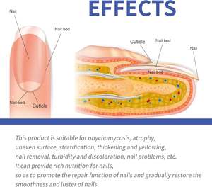 Meilleur prix Patchs pour ongles fongiques de renouvellement nocturne <span class=keywords><strong>Traitement</strong></span> de réparation des ongles <span class=keywords><strong>Traitement</strong></span> <span class=keywords><strong>antifongique</strong></span> des ongles Solution - Product Image 4
