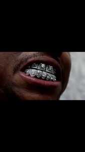 Grillz personnalisés en diamant VVS cultivé en laboratoire, en argent sterling 925 et or 10 carats, entièrement sertis de diamants ronds, testés et approuvés, prix d'usine en gros - Product Image 2