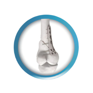 Kit d'instruments orthopédiques de pointe pour plaques de fixation de grands fragments, en acier inoxydable allemand, manuel, certifié CE, conception durable - Product Image 5