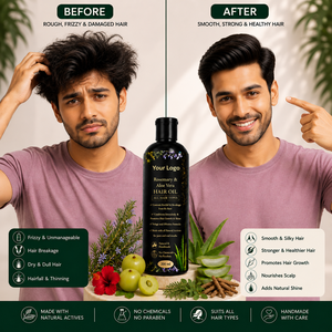 Aceite Capilar de Romero y Aloe Vera con Tu Logotipo, 200 ml, Aceite Natural a Base de Hierbas para el Crecimiento del Cabello, para Todo Tipo de Cabello, Prevención de la Caída del Cabello - Product Image 2