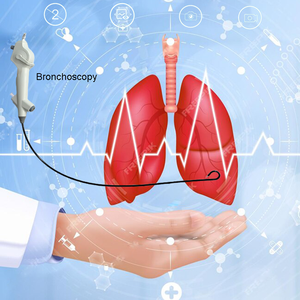 Haiye Bronchoscópio Descartável Flexível com imagem HD Bronchoscópio ENT Endoscopia nasolaringoscópio eletrônico - Product Image 3