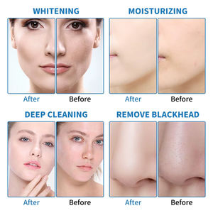 Vaporizador Facial con Lámpara <span class=keywords><strong>de</strong></span> Aumento, Rejuvenecimiento <span class=keywords><strong>de</strong></span> la Piel, Exfoliante, Lifting Facial, Limpieza Facial, 9 en 1, Máquina <span class=keywords><strong>de</strong></span> Oxígeno ABS - Product Image 5