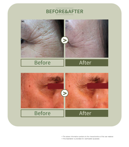 Sérum en poudre de collagène Pure Glow, soin éclaircissant et hydratant avec solution, lot de 5 flacons - Product Image 6