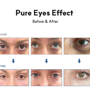 Pure Eyes PN Eye Skin Booster, Suero de Colágeno para Ojos, Estimulación de la Regeneración Celular, Reducción de Poros, Cuidado de las Ojeras, Reparación de Arrugas - Product Image 3