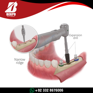 Kit de Elevación de Seno para Implantes Dentales, Instrumentos Hidráulicos para Elevación de Seno, Set de Reseñadores, Tapones y Separadores de Hueso, Kit Completo para Implantes - Product Image 3