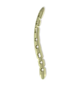 Sistema de Implantes Ortopédicos Profesionales para Fijación de Fracturas y Procedimientos Reconstructivos - Product Image 3