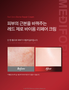 ครีมบำรุงผิวหน้า MEDIFORME Red Zero Biome Repair Cream ช่วยฟื้นฟูเกราะป้องกันผิว ขนาด 50 กรัม ผลิตแบบ ODM แบรนด์ส่วนตัว ผู้ผลิตจากเกาหลี เหมาะสำหรับทุกสภาพผิว - Product Image 2