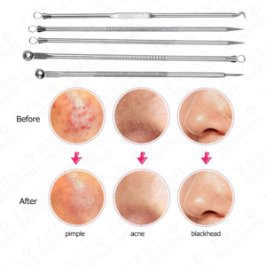 Premium 5 Piece Stainless Steel Blackhead Acne Extractor Kit Comedone Removal <b>Tools</b> for Clear Healthy Skin - Product Image 5