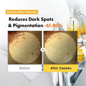 [SAMPLE] Apothe Exo Some Mela-Glu Ampolla Blanqueadora para Manchas Oscuras 30ml, Suero Iluminador con Niacinamida de Uva, Limpiador Facial Coreano - Product Image 6