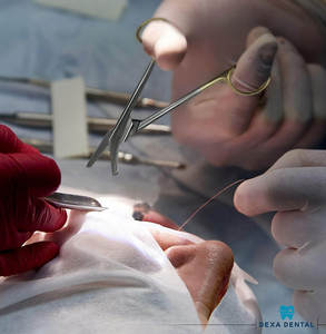 กรรไกรตัดลวดสแตนเลส กรรไกรตัดลวดสำหรับงานทันตกรรมและศัลยกรรม - Product Image 6