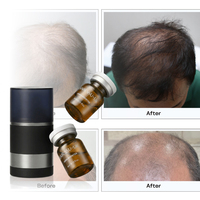OEM PDRN Niacinamid Haarwuchs-Booster für Männer, Kopfhaut-Serum gegen Haarausfall, Private Label 40ml, Stimulierend für dünner werdendes Haar
