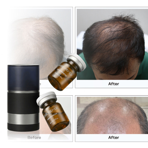 Suero Capilar OEM PDRN para Hombres, Tratamiento Anticaída, Etiqueta Privada, Solución Estimulante del Crecimiento del Cabello, Venta al Por Mayor - Product Image 3