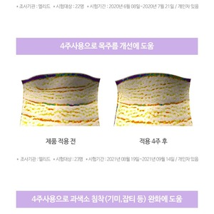 Set de Cuidado de la Piel Antienvejecimiento K Beauty de Corea, 4 Piezas, Crema Reparadora y Crema Reafirmante de Doble Caviar Negro - Product Image 6