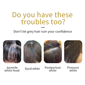 <span class=keywords><strong>Traitement</strong></span> naturel en gros de cheveux gris de fines herbes blanc à la crème noire pour le <span class=keywords><strong>traitement</strong></span> de cheveux - Product Image 2