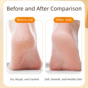 Râpe à pieds double face en bois, étanche avec trou de suspension, éliminateur de callosités, utilisation humide et sèche, facile à nettoyer - Product Image 5