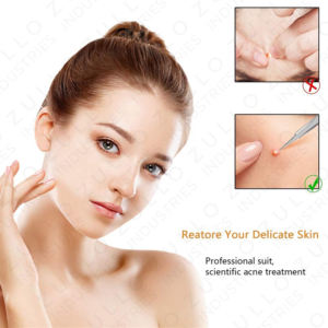 ชุดเครื่องมือดูแลผิวหน้าสำหรับผ่าตัด กำจัดสิวเสี้ยน สิวอักเสบ ทำจากเหล็กกล้าไร้สนิมทางการแพทย์ ใช้ซ้ำได้ - Product Image 4