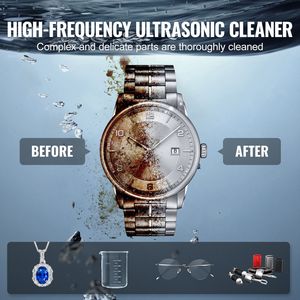 Pulitore a Ultrasuoni Digitale in Metallo da 15L 360W 40kHz con Nuova Modalità Delicata e Degassaggio Migliorato - Product Image 6