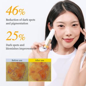 ยาดาห์ วิตามินซี 30% ไวท์เทนนิ่ง ดาร์ก สปอต คอร์เรคติ้ง บาล์ม 10 กรัม แบบหลอด ผสมวิตามินอีบริสุทธิ์จากกรดแอสคอร์บิก สำหรับการบำรุงผิวให้กระจ่างใสอย่างเป็นจุดๆ - Product Image 3