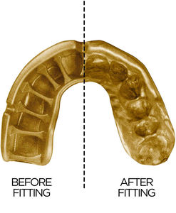 Protège-dents sportif pour adultes et juniors avec étui pour la boxe, le basketball, le football, le MMA, le hockey et autres sports - Product Image 2