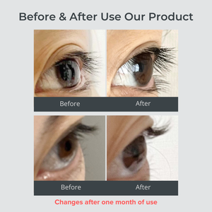 Safety Testing Free Formula Gentle Everyday Use Eyelash Serum Private Label <b>Dropshipping</b> - Product Image 5