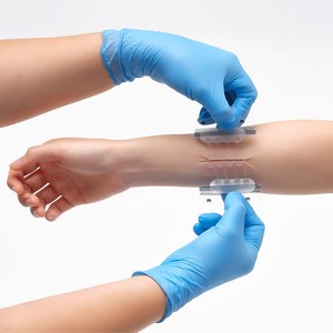 แผ่นปิดแผล Surginus Emergency Wound Closure Strips ชุดเย็บแผลแบบเต็มแถบ 03 แผ่นปิดแผลแบบมีกาวในตัว - Product Image 4