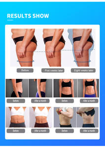 Máquina 2 en 1 de Terapia Endo con Rodillo de Bolas Internas 360° para Drenaje Linfático, Celulitis, Masaje Profundo, Adelgazamiento y Moldeamiento Corporal - Product Image 4