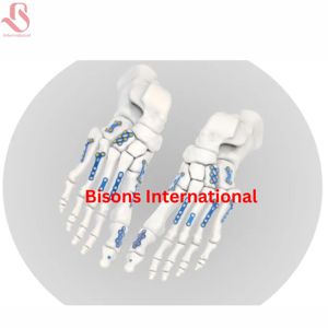 ชุดเครื่องมือผ่าตัดกระดูกข้อเท้าและเท้าแบบไทเทเนียมสำหรับขายส่ง สำหรับการผ่าตัดกระดูกและข้อและศัลยกรรมกระดูกหัก - Product Image 3