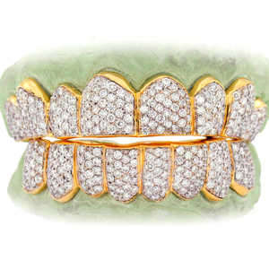 Grillz Hip Hop de Luxe Plaqué Or, Ensemble Complet Sertie de Diamants Ronds, Finition Personnalisée, Bijoux pour Dents - Product Image 1