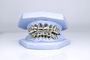 Personalizado de fábrica 1-10 Top 1-10 Bottom Real S925 Silver 10K 14K 18K Solid Filled Gold Grillz - Product Image 3