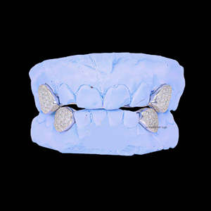 Grillz en argent sterling plaqué or avec diamants Moissanite taille brillant, micro-incrustation, unisexe, style Hip Hop, crocs de vampire, pour boîte de nuit - Product Image 1