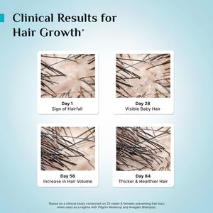 Pilgrim Redensyl 3% + Anagain 4% + 5% Capilia Stem Advanced Hair Growth Serum - 1.01 fl oz (30 ml) - Product Image 4